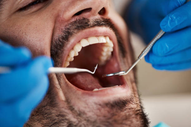 Best Emergency Dentist for Special Needs Patients in East Lexington, VA