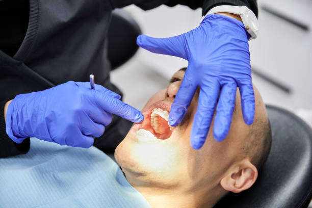 Best Emergency Dental Care for Abscessed Tooth in East Lexington, VA